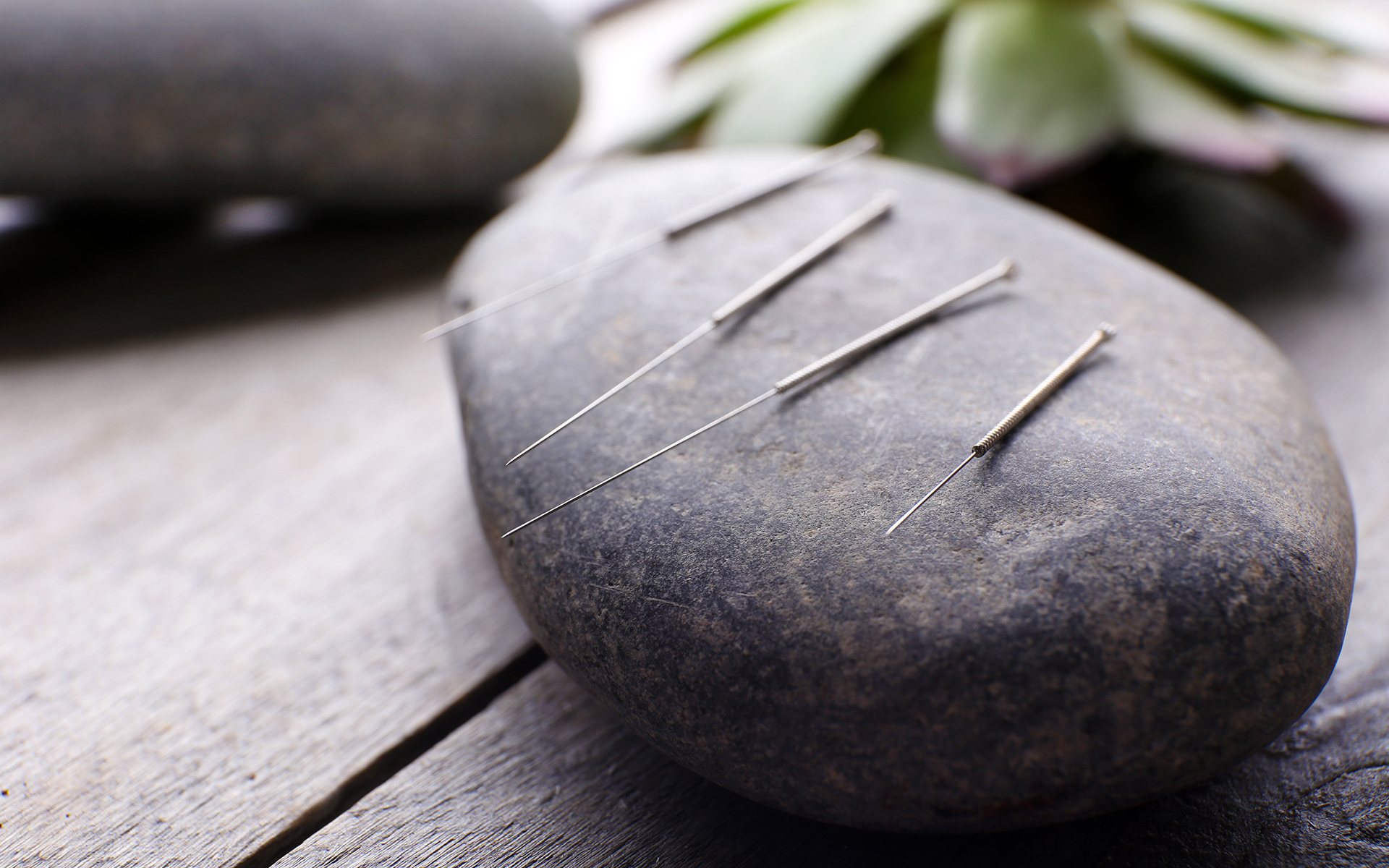 Acupuncture Luna Acupuncture